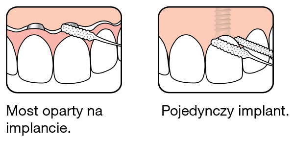 floss