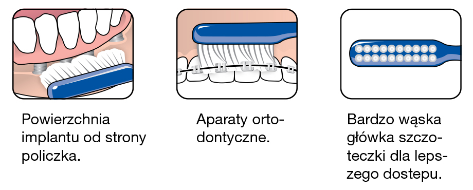 orhodonic