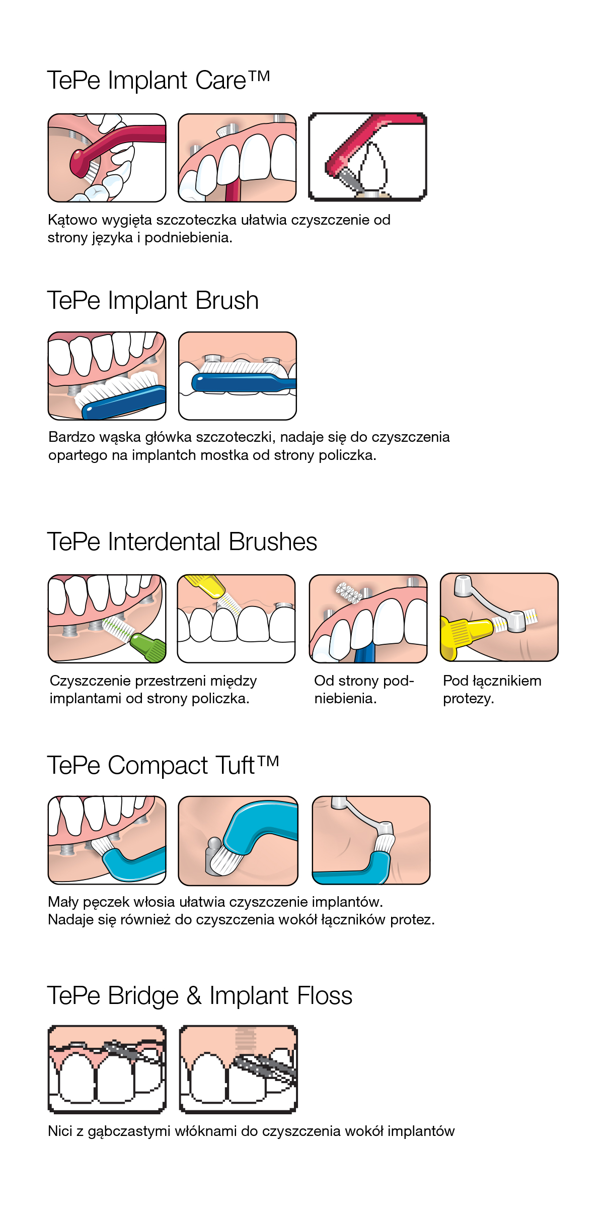 tepe_implant